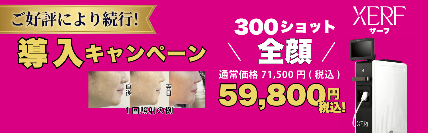 XERFザーフ高周波RF安いキャンペーン都内 美容皮膚科