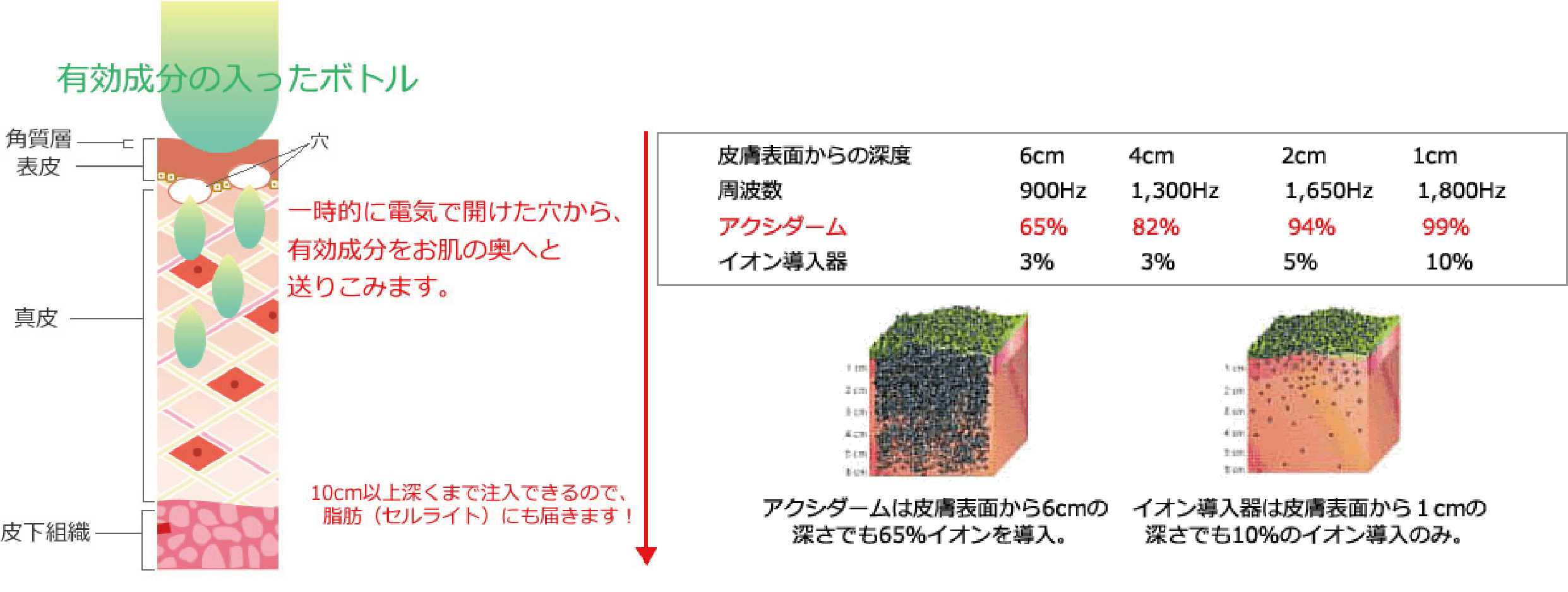 イオン導入とは違う