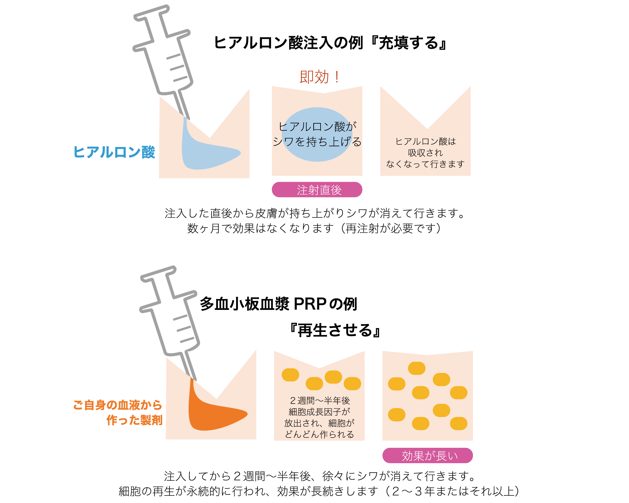 クリミディア勃起不全