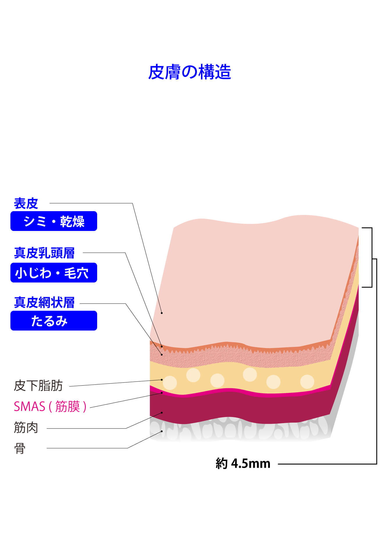 SMAS筋膜と皮膚支帯・支持靭帯