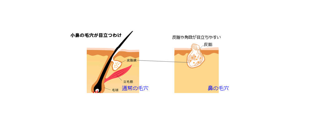 毛が生えるための穴