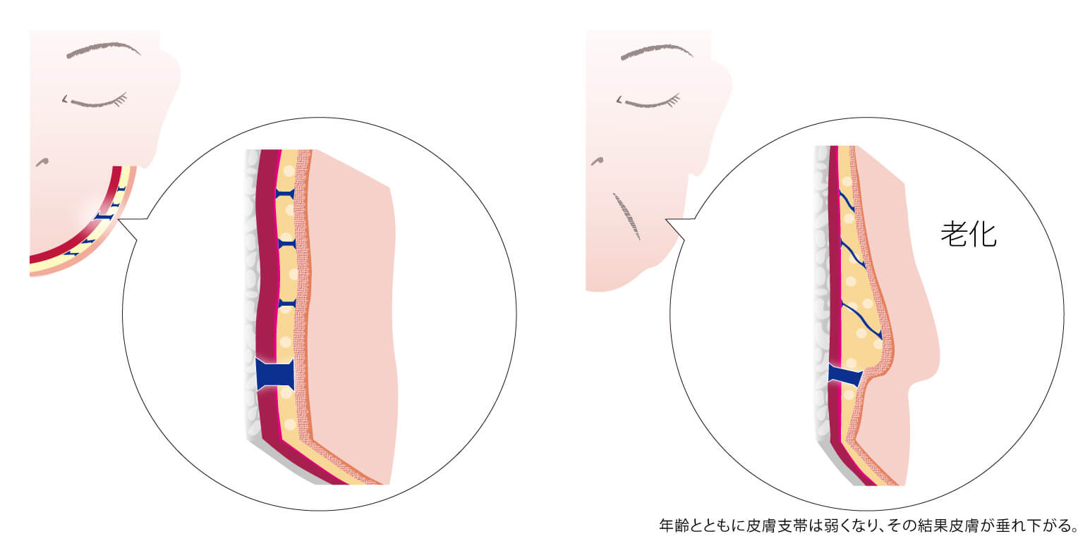 筋膜 SMAS 靭帯 リテイニングリガメント